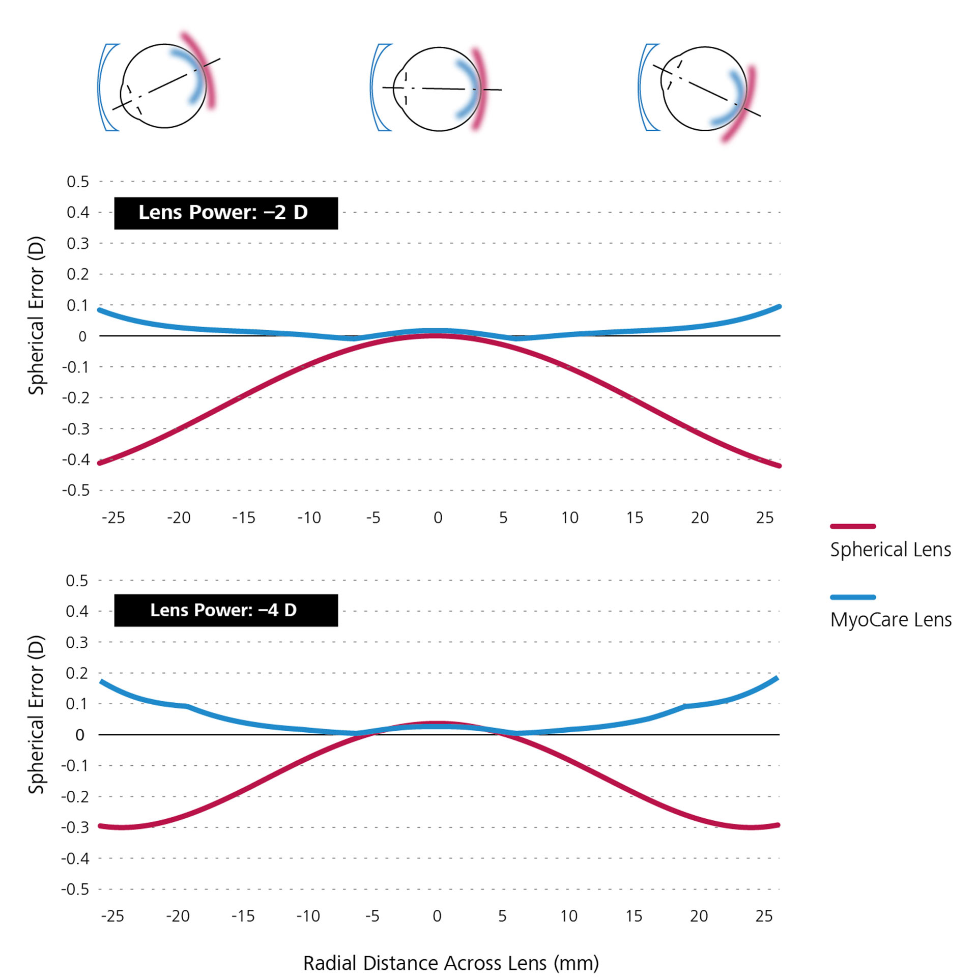 Dos gráficos lineales que muestran la simulación matemática comparativa de los lentes esféricos de visión sencilla (en rojo) y los lentes MyoCare (en azul).