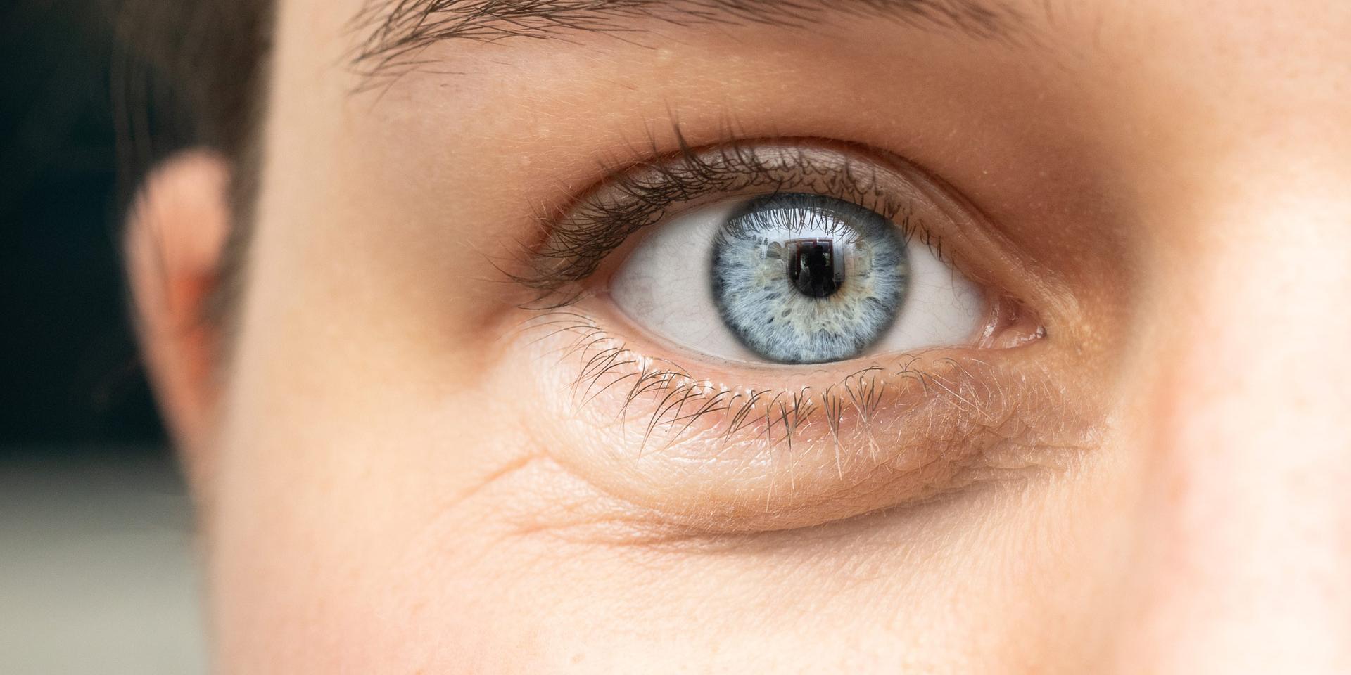 Ojos inflamados