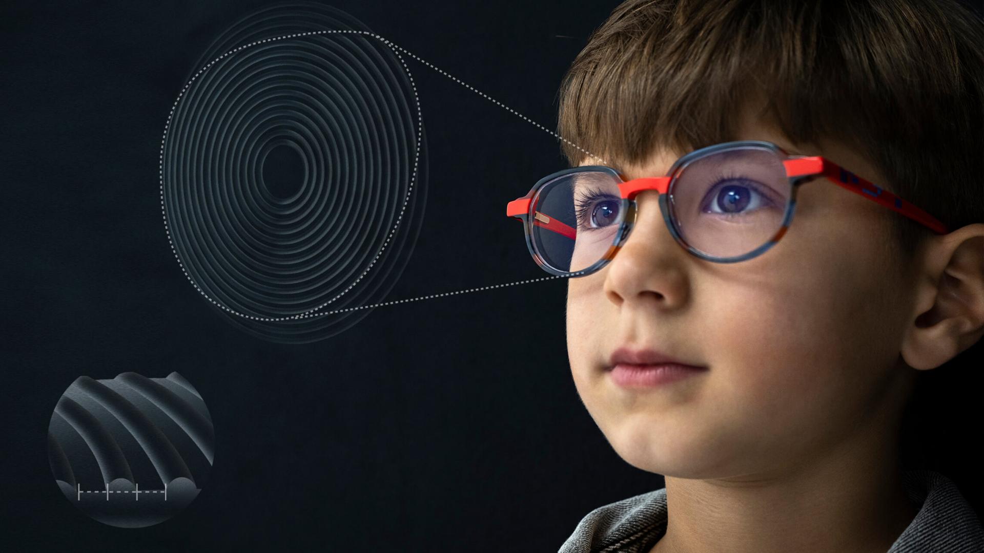 Ilustración de un primer plano del diseño de los lentes ZEISS MyoCare para el control de la miopía en niños.